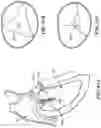 Fig. 106 - CARDIAC VALVE REPAIR DEVICES AND ASSOCIATED SYSTEMS AND METHODS