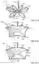 Fig. 114 - CARDIAC VALVE REPAIR DEVICES AND ASSOCIATED SYSTEMS AND METHODS