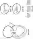 Fig. 15 - CARDIAC VALVE REPAIR DEVICES AND ASSOCIATED SYSTEMS AND METHODS