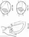 Fig. 16 - CARDIAC VALVE REPAIR DEVICES AND ASSOCIATED SYSTEMS AND METHODS