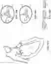 Fig. 17 - CARDIAC VALVE REPAIR DEVICES AND ASSOCIATED SYSTEMS AND METHODS