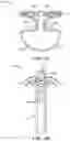 Fig. 18 - CARDIAC VALVE REPAIR DEVICES AND ASSOCIATED SYSTEMS AND METHODS