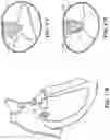Fig. 22 - CARDIAC VALVE REPAIR DEVICES AND ASSOCIATED SYSTEMS AND METHODS