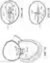 Fig. 28 - CARDIAC VALVE REPAIR DEVICES AND ASSOCIATED SYSTEMS AND METHODS