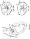 Fig. 30 - CARDIAC VALVE REPAIR DEVICES AND ASSOCIATED SYSTEMS AND METHODS