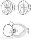 Fig. 31 - CARDIAC VALVE REPAIR DEVICES AND ASSOCIATED SYSTEMS AND METHODS