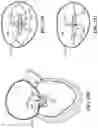 Fig. 34 - CARDIAC VALVE REPAIR DEVICES AND ASSOCIATED SYSTEMS AND METHODS