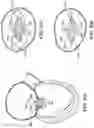 Fig. 37 - CARDIAC VALVE REPAIR DEVICES AND ASSOCIATED SYSTEMS AND METHODS