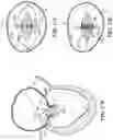Fig. 40 - CARDIAC VALVE REPAIR DEVICES AND ASSOCIATED SYSTEMS AND METHODS