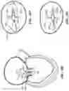 Fig. 42 - CARDIAC VALVE REPAIR DEVICES AND ASSOCIATED SYSTEMS AND METHODS