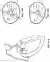 Fig. 43 - CARDIAC VALVE REPAIR DEVICES AND ASSOCIATED SYSTEMS AND METHODS