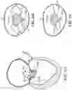 Fig. 45 - CARDIAC VALVE REPAIR DEVICES AND ASSOCIATED SYSTEMS AND METHODS