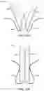 Fig. 46 - CARDIAC VALVE REPAIR DEVICES AND ASSOCIATED SYSTEMS AND METHODS