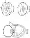Fig. 47 - CARDIAC VALVE REPAIR DEVICES AND ASSOCIATED SYSTEMS AND METHODS