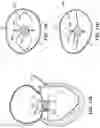 Fig. 49 - CARDIAC VALVE REPAIR DEVICES AND ASSOCIATED SYSTEMS AND METHODS