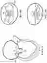 Fig. 53 - CARDIAC VALVE REPAIR DEVICES AND ASSOCIATED SYSTEMS AND METHODS