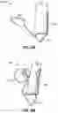 Fig. 54 - CARDIAC VALVE REPAIR DEVICES AND ASSOCIATED SYSTEMS AND METHODS
