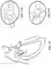 Fig. 59 - CARDIAC VALVE REPAIR DEVICES AND ASSOCIATED SYSTEMS AND METHODS