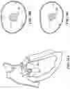 Fig. 60 - CARDIAC VALVE REPAIR DEVICES AND ASSOCIATED SYSTEMS AND METHODS