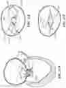 Fig. 64 - CARDIAC VALVE REPAIR DEVICES AND ASSOCIATED SYSTEMS AND METHODS