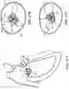 Fig. 71 - CARDIAC VALVE REPAIR DEVICES AND ASSOCIATED SYSTEMS AND METHODS