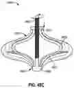 Fig. 73 - CARDIAC VALVE REPAIR DEVICES AND ASSOCIATED SYSTEMS AND METHODS