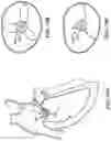 Fig. 75 - CARDIAC VALVE REPAIR DEVICES AND ASSOCIATED SYSTEMS AND METHODS