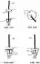 Fig. 77 - CARDIAC VALVE REPAIR DEVICES AND ASSOCIATED SYSTEMS AND METHODS
