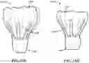 Fig. 84 - CARDIAC VALVE REPAIR DEVICES AND ASSOCIATED SYSTEMS AND METHODS