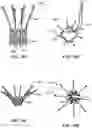 Fig. 85 - CARDIAC VALVE REPAIR DEVICES AND ASSOCIATED SYSTEMS AND METHODS