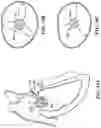Fig. 87 - CARDIAC VALVE REPAIR DEVICES AND ASSOCIATED SYSTEMS AND METHODS