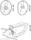 Fig. 88 - CARDIAC VALVE REPAIR DEVICES AND ASSOCIATED SYSTEMS AND METHODS