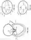 Fig. 92 - CARDIAC VALVE REPAIR DEVICES AND ASSOCIATED SYSTEMS AND METHODS