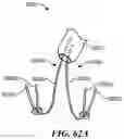 Fig. 93 - CARDIAC VALVE REPAIR DEVICES AND ASSOCIATED SYSTEMS AND METHODS
