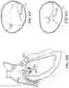 Fig. 96 - CARDIAC VALVE REPAIR DEVICES AND ASSOCIATED SYSTEMS AND METHODS