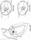 Fig. 97 - CARDIAC VALVE REPAIR DEVICES AND ASSOCIATED SYSTEMS AND METHODS