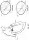 Fig. 98 - CARDIAC VALVE REPAIR DEVICES AND ASSOCIATED SYSTEMS AND METHODS