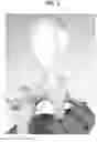 Fig. 02 - Hip joint tether device