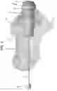 Fig. 03 - Hip joint tether device