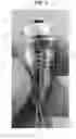 Fig. 06 - Hip joint tether device