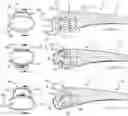 Fig. 01 - BONE JOINT IMPLANTS