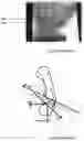 Fig. 02 - BONE JOINT IMPLANTS