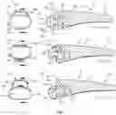 Fig. 06 - BONE JOINT IMPLANTS