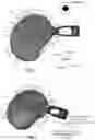 Fig. 02 - Asymmetrically expandable cage