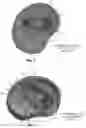 Fig. 03 - Asymmetrically expandable cage