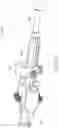 Fig. 68 - Cervical plate and inserter
