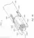 Fig. 92 - Cervical plate and inserter