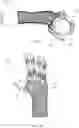 Fig. 02 - PROSTHETIC DIGIT WITH ARTICULATING LINKS