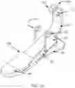Fig. 06 - Computer-controlled ankle-foot prosthesis with series J-spring actuation