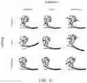 Fig. 16 - Computer-controlled ankle-foot prosthesis with series J-spring actuation